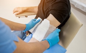 Nanofibrous Dressing Could Help Accelerate Severe Burn Healing