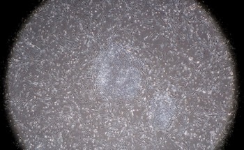 iPSCs-Derived Neurons Successfully Grown on Nanowire Arrays