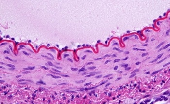 Certain Nanoplastics Can Cause Holes Between Endothelial Cells
