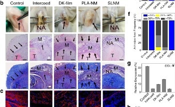 Development of Nano-Skin to Prevent Post-Operative Adhesion