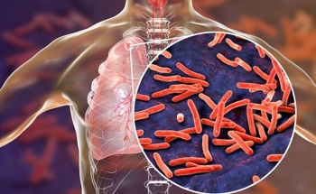Seaweed Suggested As Source of Anti-Tuberculosis Nanoparticles