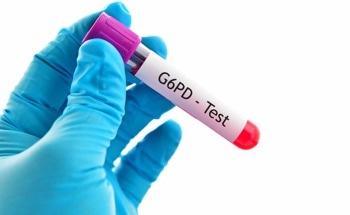 Ratiometric Fluorescence Approach to Detecting G6PD