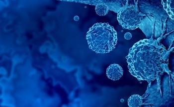 Opening up the Potential of Carbon Dots in Tumor Therapy