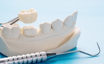 Nanopillar Film Enhances Properties of Dental Implant Coating