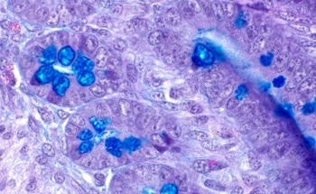 Impact of Food-Derived Metal Oxide Nanoparticles on Intestine
