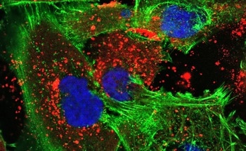 Merging Technologies to Tackle Brain Tumors