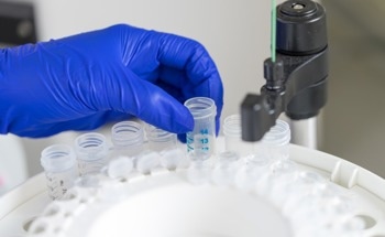 Researchers Hope to Reduce the Cost of Protein Purification