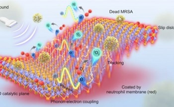 Novel 2D Ultrasound-Responsive Antibacterial Nanosheets Effectively Address Bone Tissue Infection