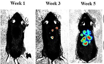 Using Nanodiamonds to Stop Melanoma Tumor Metastases