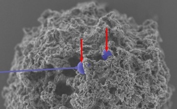 Taking a Nanoscale Approach to Avoid Allergic Reactions