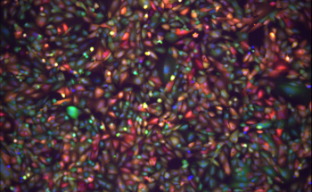 Another Step Towards Crossing the Blood-Brain Barrier