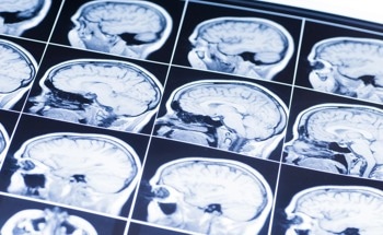 Nanoparticles Detect Brain Target Engagement