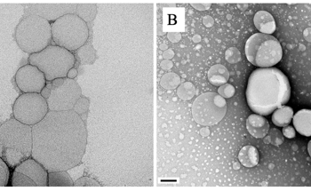 Advancing Treatment for Visceral Leishmaniasis with Nanomedicine
