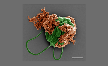 Microrobots Evade Immune System to Deliver Cancer Drugs