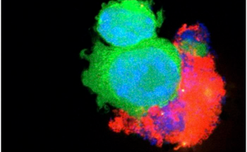 ‘Dual Action’ Treatment to Enhance Lung Cancer Treatment