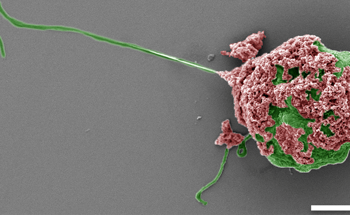 Microrobots Deliver Cytokine Neutralizers Directly to Inflamed Colons