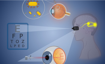 Gold Nanoparticles to Restore Vision in Retinal Disorders