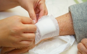 Enhanced Antibacterial Polylactic Acid-Curcumin Nanofibers for Wound Dressings