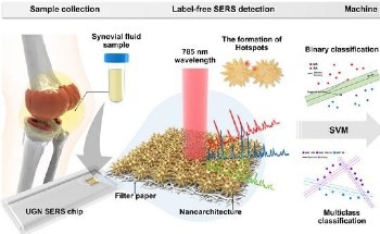 Sea Urchin-Shaped Nanostructures Enable Ultra-Fast Arthritis Testing