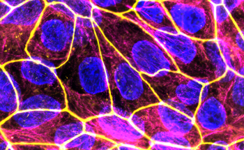 Developing Safe Nanozyme Therapies for Inflammatory Conditions During Pregnancy