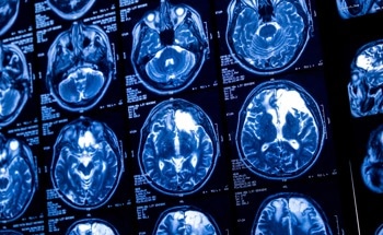 New Research Reveals Nanoplastics’ Damaging Effect on Brain Cells