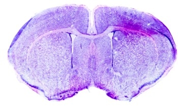 Groundbreaking Nanoparticle Therapy Reverses Alzheimer's Disease in Mice