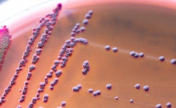 Plant Powered Quantum Dots Tackle Microbes and Toxic Dyes