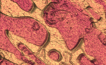 Metal Alloys From a New Perspective