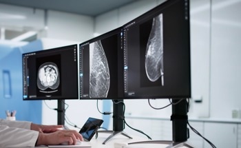 Magnetic Nanoparticles Could Make Doxorubicin Delivery More Precise