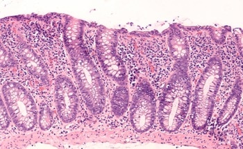 Microbiome-Activated Nanogel Successfully Delivers Butyrate in Mice