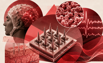Nanostructured Platinum Boosts Dry Microneedle EEG Performance