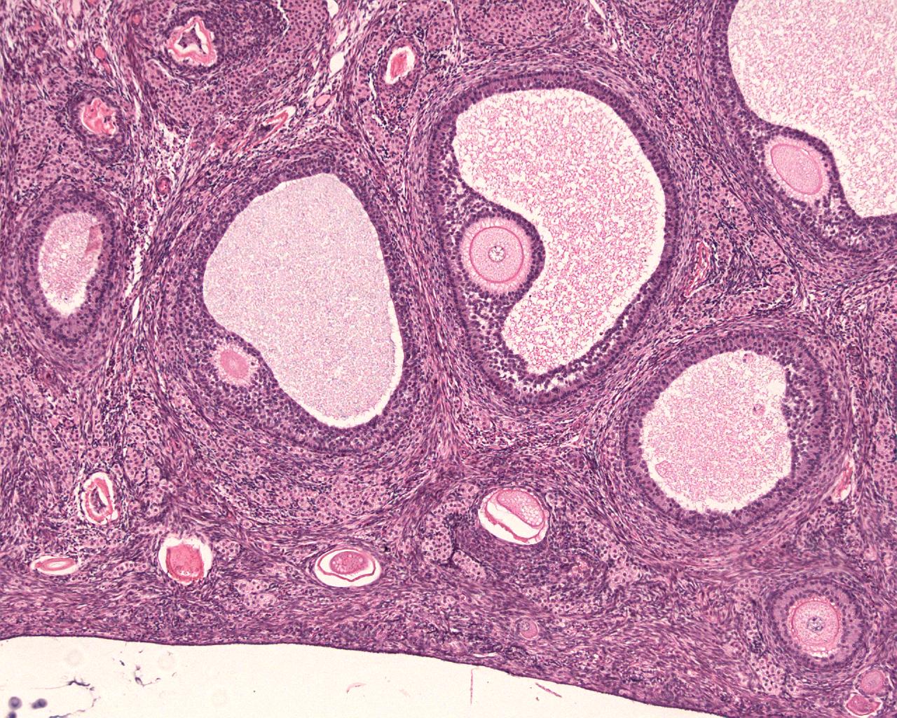 Яйценосный бугорок на фолликуле гистология. Яйцеклетка в фолликуле. Яйценосный бугорок на фолликуле. Антральный фолликул 5. Антральный фолликул 5.