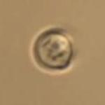 Trapping of Yeast Cells Using NanoTracker Optical Tweezers from JPK Instruments