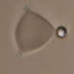 Bead Manipulation of RBC Using Optical Tweezers from JPK Instruments
