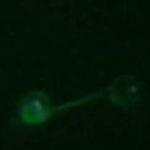 NanoTracker fluorescent Microtubule Manipulation from JPK