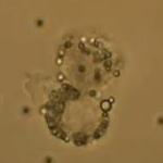 Macrophage Cell Manipulation by Optical Tweezers from JPK Instruments