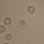 Transportation of RBC Using Optical Tweezers from JPK instruments