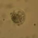  Macrophage Cell Tether Pulling by Optical Tweezers from JPK Instruments