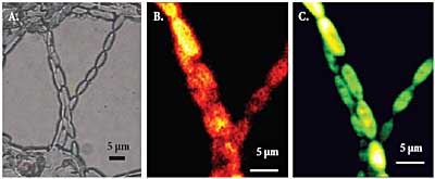 Microalgae seen by bright field microscopy (A), Raman microscopy at beta-carotene line (B), and confocal microscopy of autofluorescence (C). Sample courtesy of Dr. Don McNaughton, Monash University, Victoria, Australia.