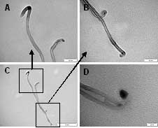 (A – C) TEM images showing two overlying MWNTs, both with two closed ends and possible metal catalyst particles at each end suggesting bottom up tube growth. (D) TEM image of a kink defect in a MWNT containing metal catalyst.