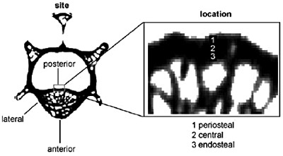 Schematic representation of the indent areas. On transversal slices of lumbar vertebral body, three sites were chosen: anterior, posterior, and lateral sites (see left figure). On each site, three locations were defined as structure of interest: the periosteal, central, and endosteal locations (see right part of the figure).