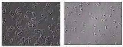 AZoNano, Nanotechnology - Figure showing the different nucleation of neuron cultures grown on polycrystalline and amorphous silicon carbide.